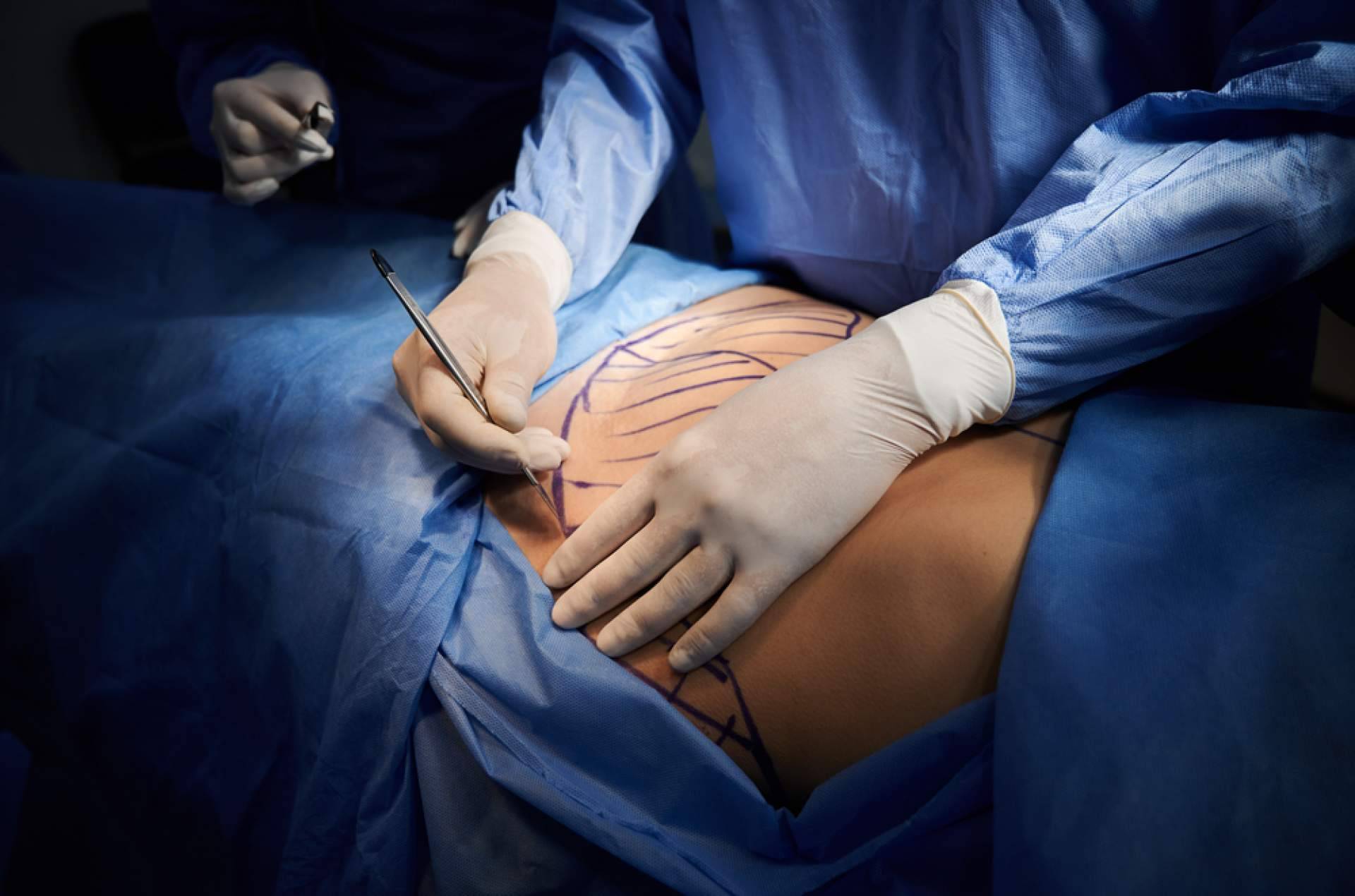 La cirugía de reducción de pecho puede ayudar a mejorar la calidad de vida, con A2Clinic