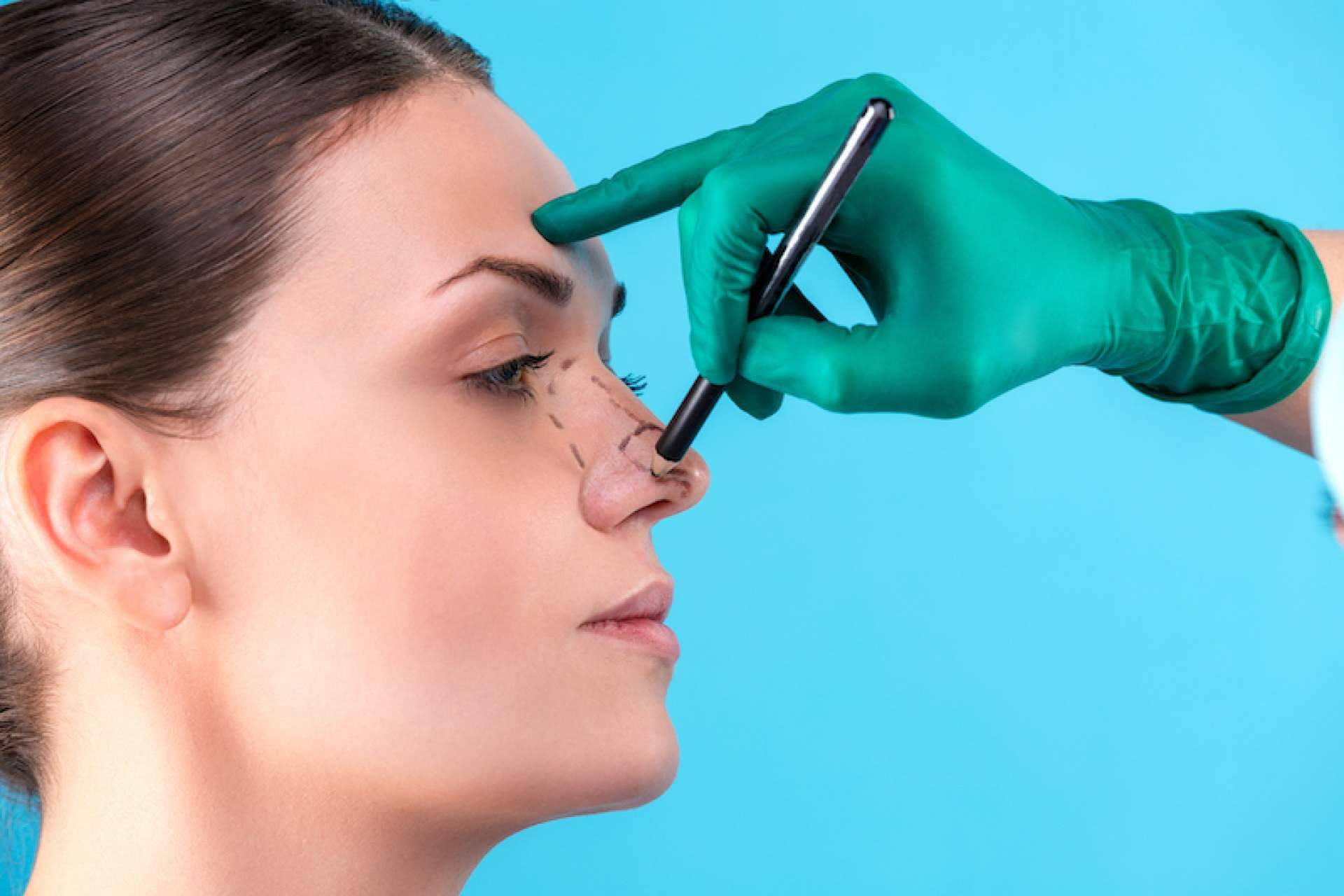 Clínica Dr. Millán Mateo se especializa en rinoplastia ultrasónica en Madrid