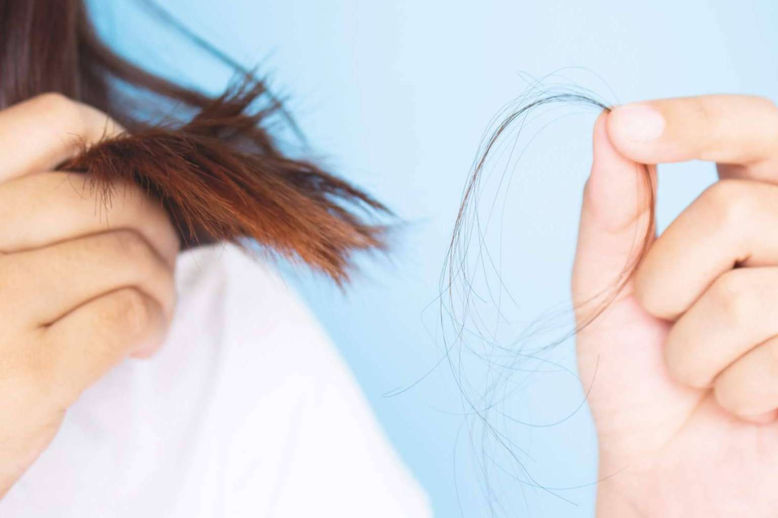 ¿Cómo se puede saber si se tiene alopecia?