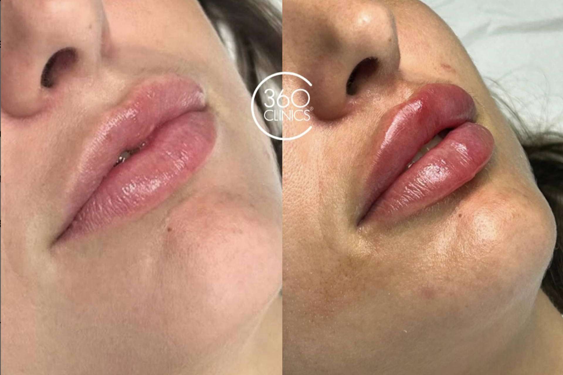 Espejito espejito, quién tiene los labios más bonitos