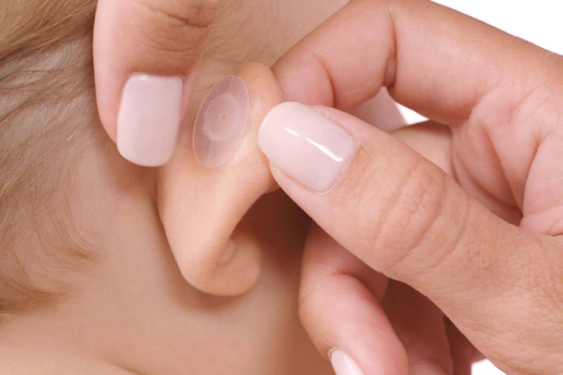 Corregir las orejas de soplillo en bebés y niños, con Otostick Bebé