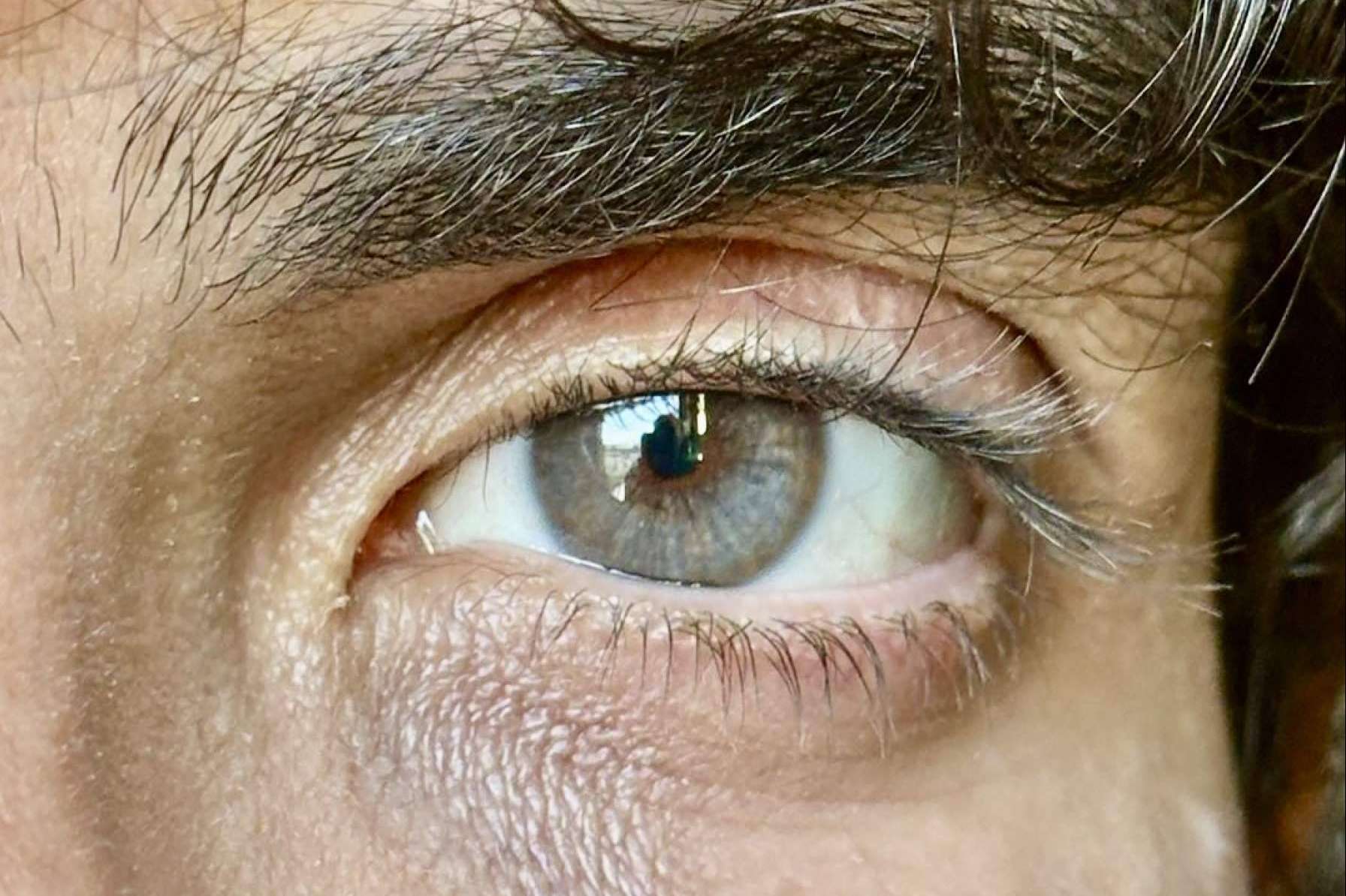 Es posible cambiar el color de los ojos eliminando selectivamente los tipos de melanina