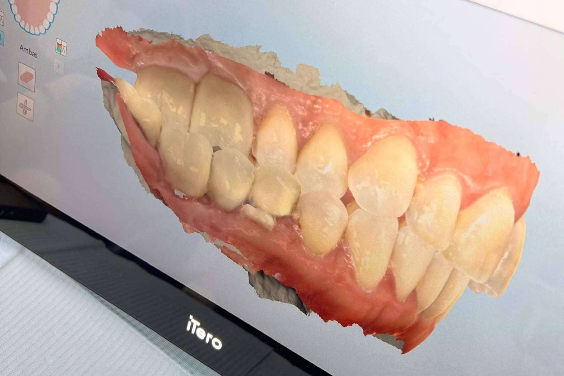Clínicas Nobel incorpora simulaciones dentales y tecnología avanzada para una experiencia personalizada