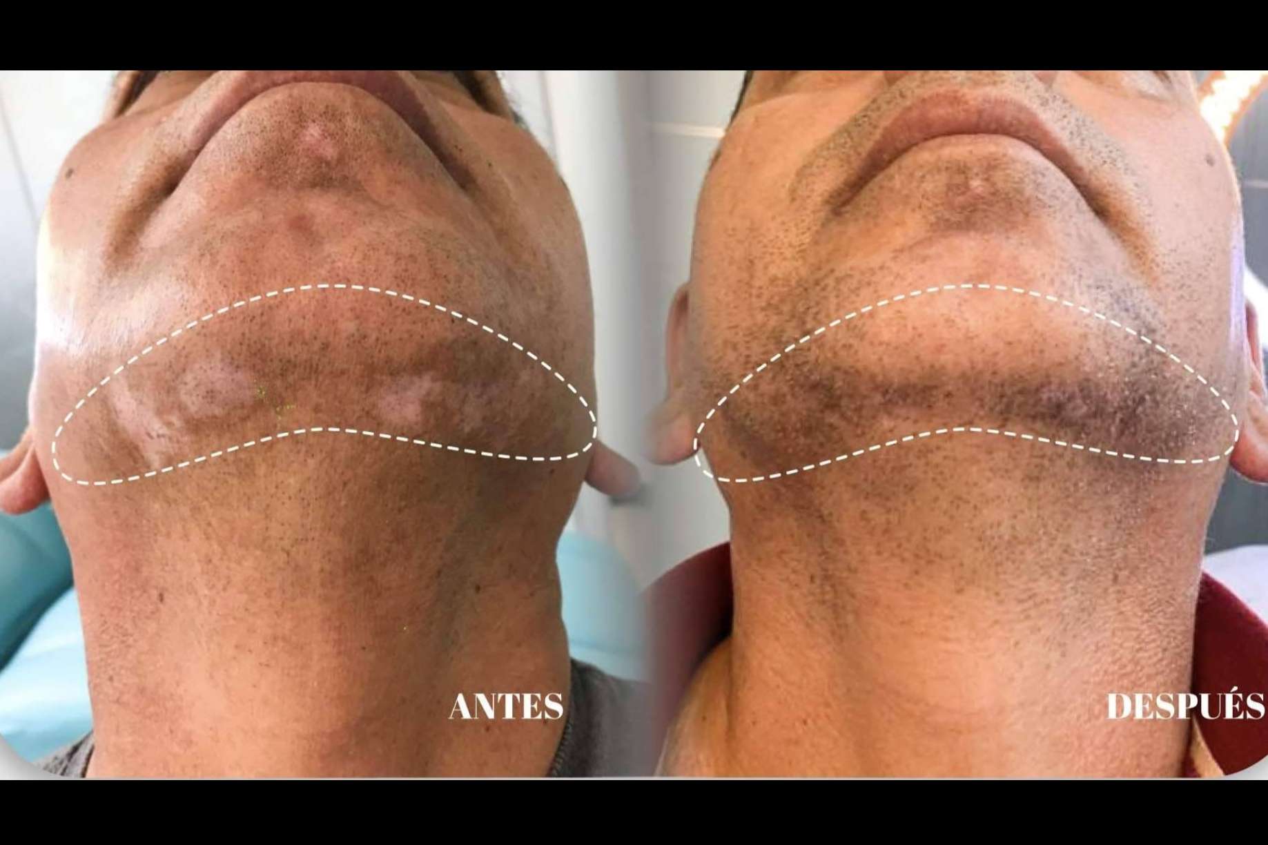 La Dra. Janeth Arévalo implementa terapia combinada para el tratamiento del vitiligo en Clínica God Bless en Loja