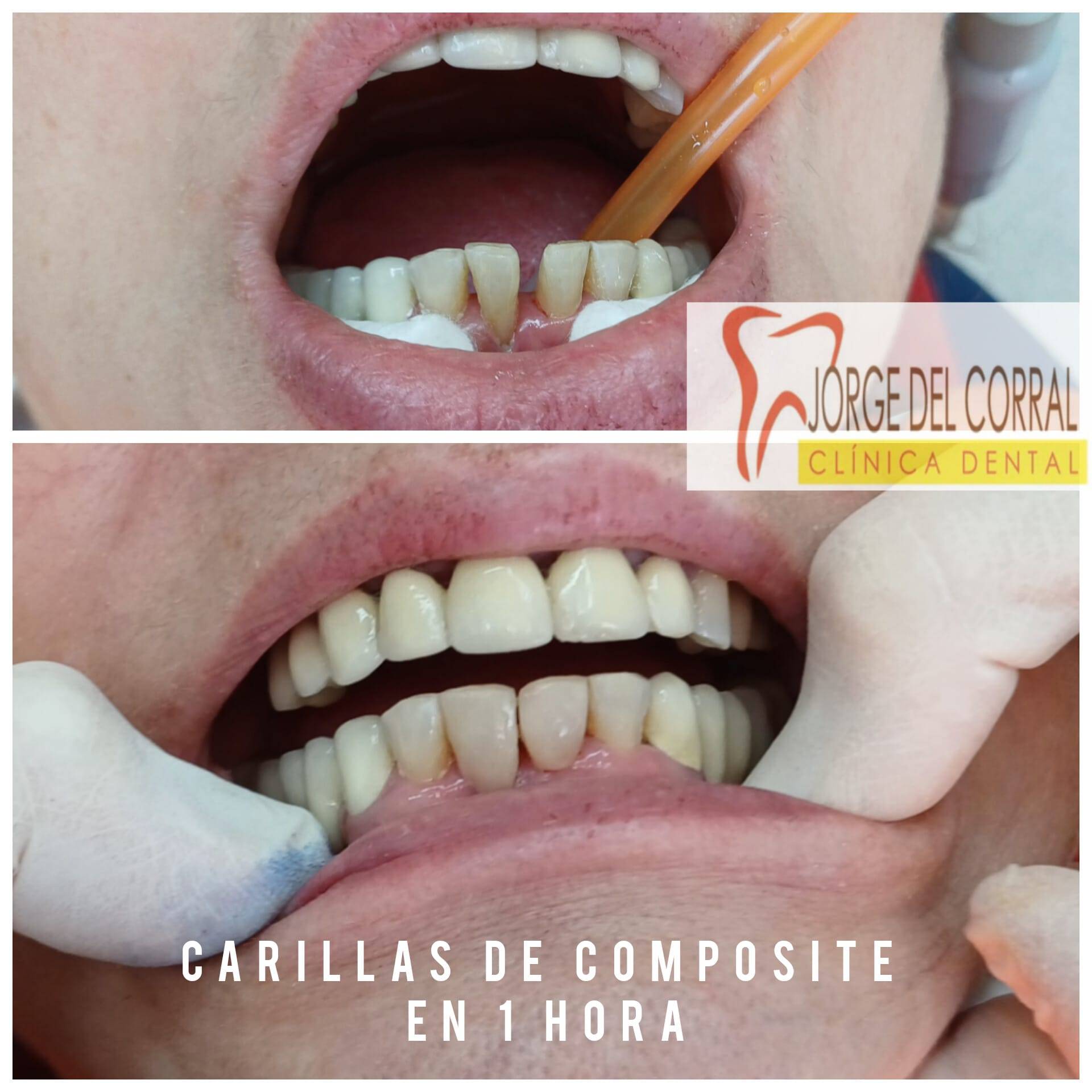 Jorge del Corral, la clínica dental que une calidad, precio y estética en Hortaleza