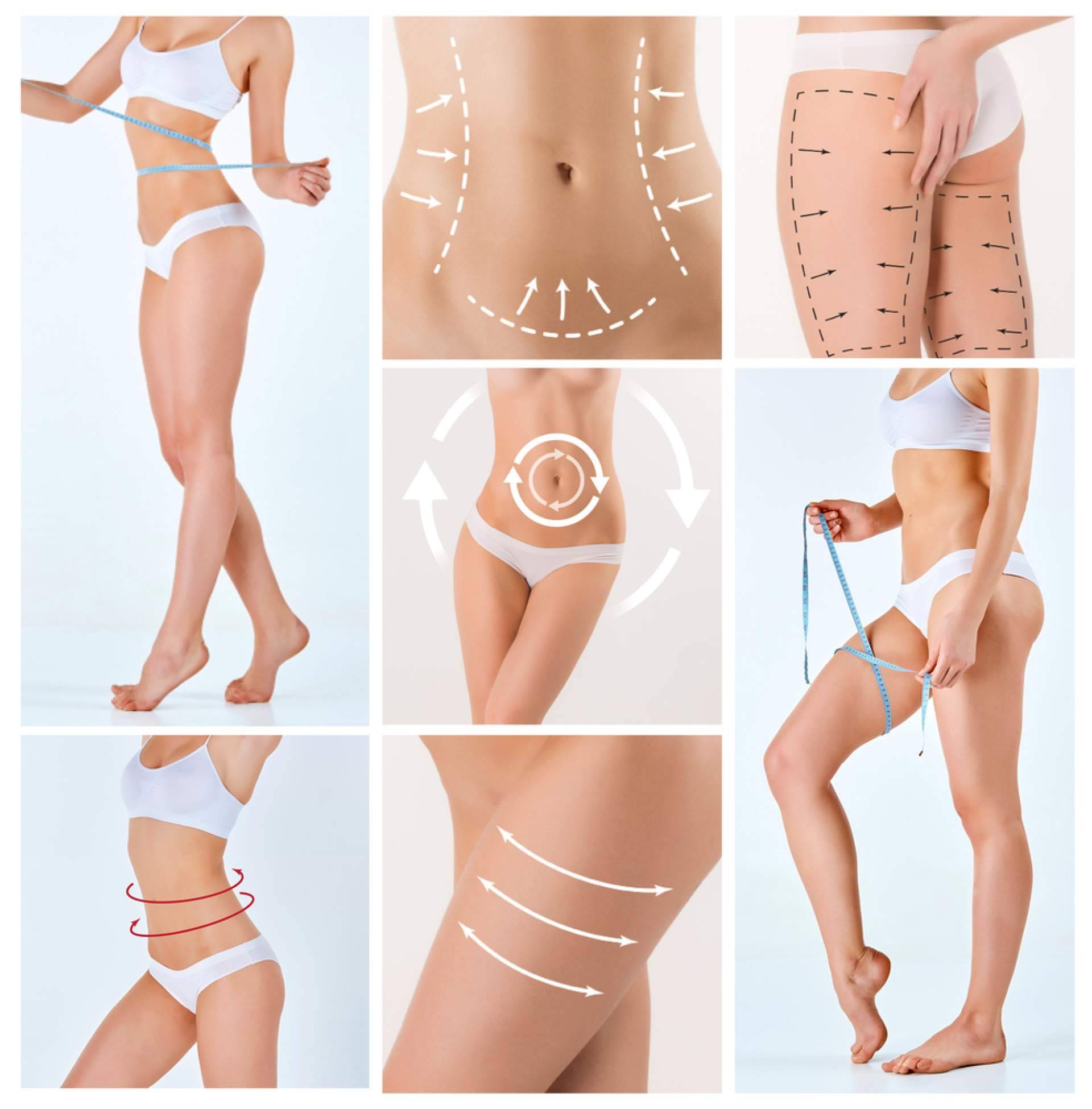 Beauty&Beauty apuesta por la Lipoescultura HD con Lipováser para redefinir el contorno corporal