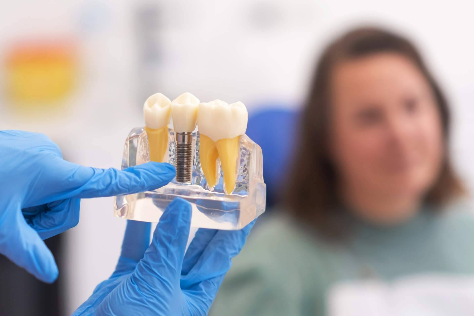 Crece la apuesta por los implantes dentales como alternativa definitiva a la ausencia de dientes