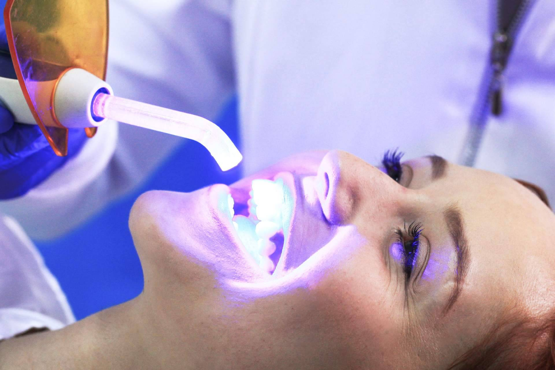 Odontología de Marlon Becerra, referente en diseño de sonrisa en Bogotá y odontología estética avanzada