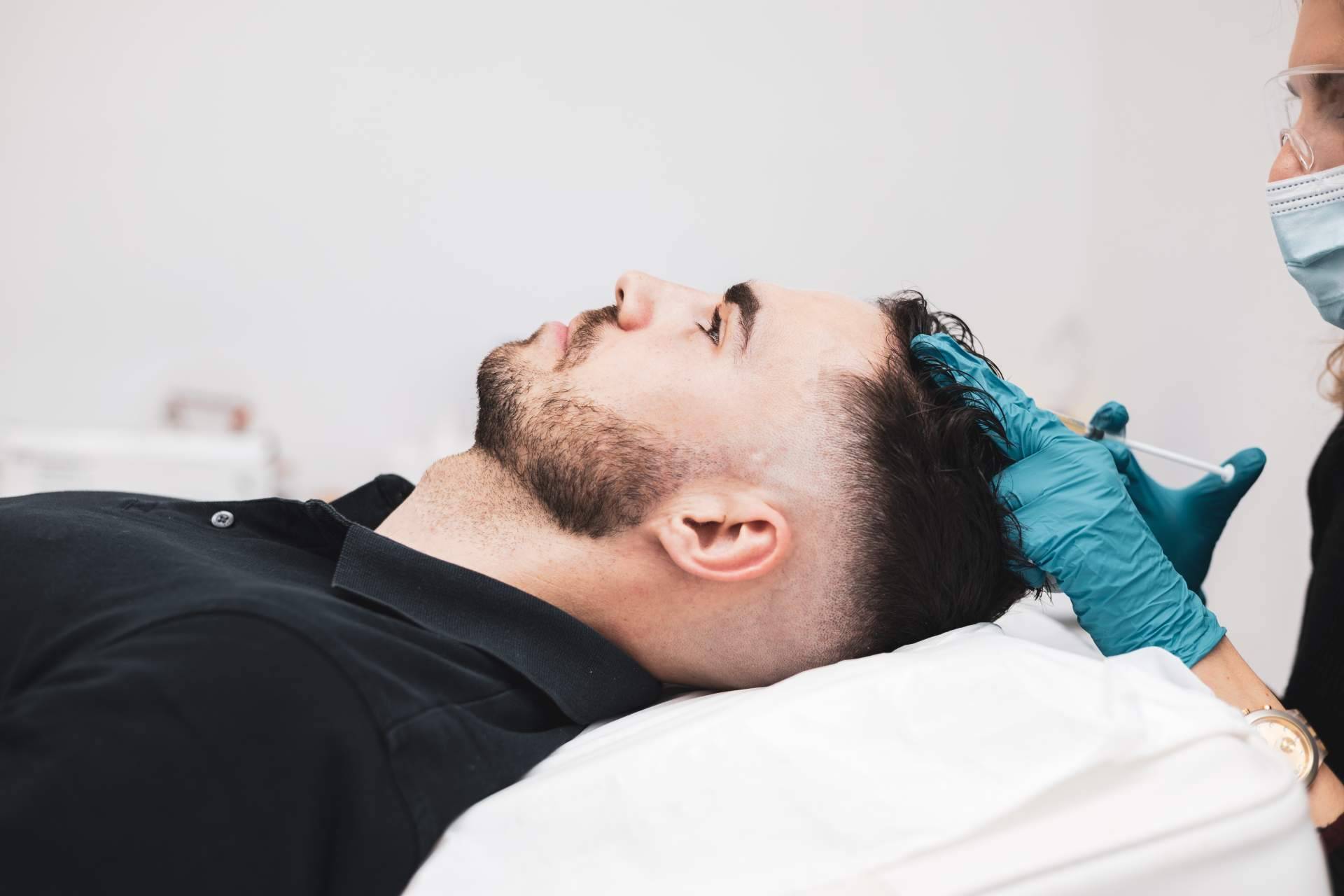 La mesoterapia capilar se abre paso como complemento al trasplante capilar en casos de pérdida de cabello