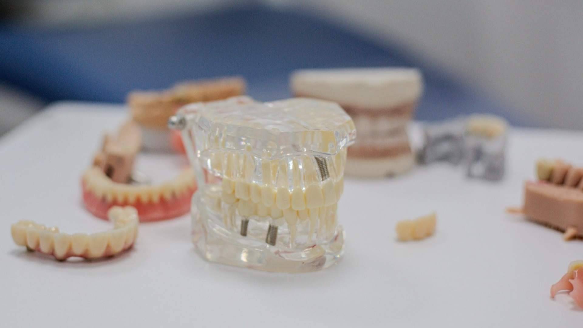 Sector Dental revoluciona los implantes dentales en Madrid por menos de 2€ al día